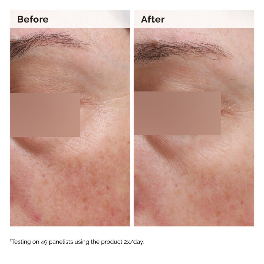 niacinamide-5-face-and-body-emulsion-m6 2024-08-23-ORD-Nia-5pct-Face-Body-B-A-Elasticity-Global-02-1x1.jpg