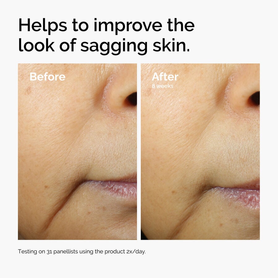 caffeine-3-escin-1-face-serum-g4 ord-caffeine-3pct-escin-1pct-face-serum-before-after-sagging.jpg