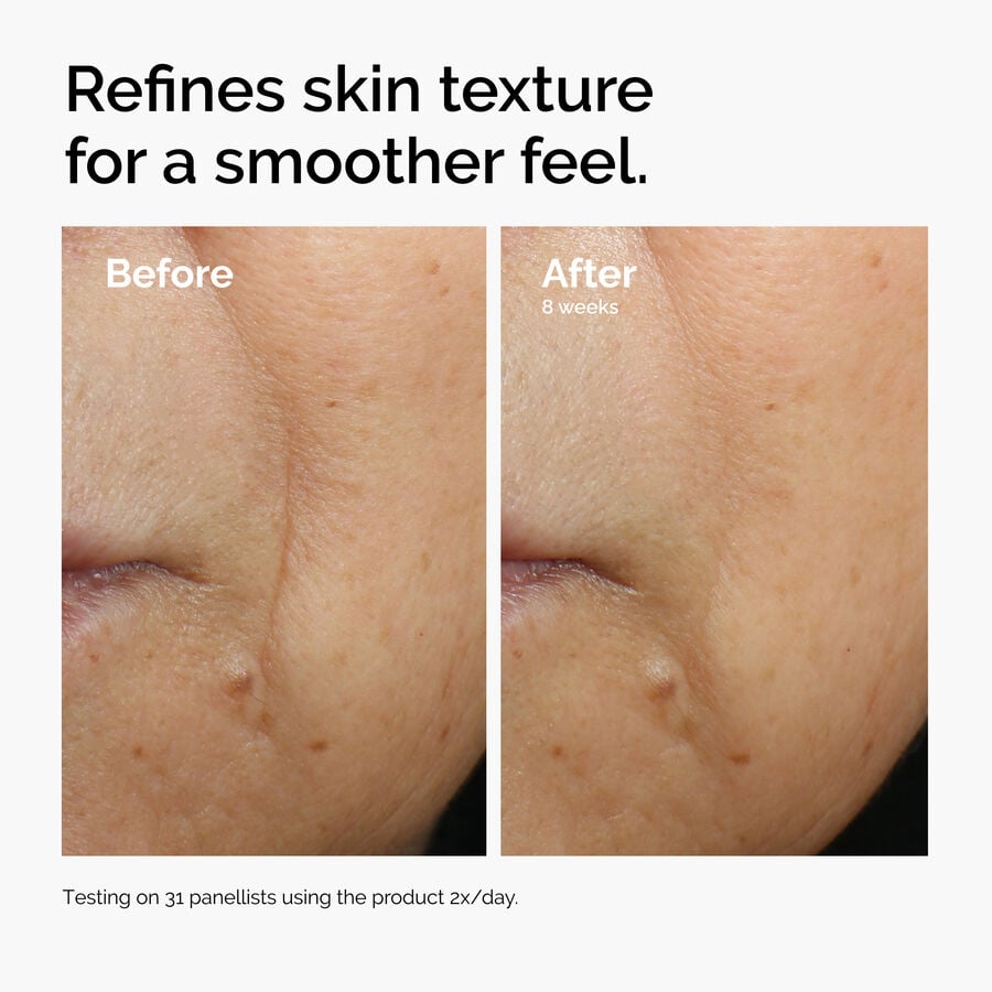 caffeine-3-escin-1-face-serum-g4 ord-caffeine-3pct-escin-1pct-face-serum-before-after-texture.jpg