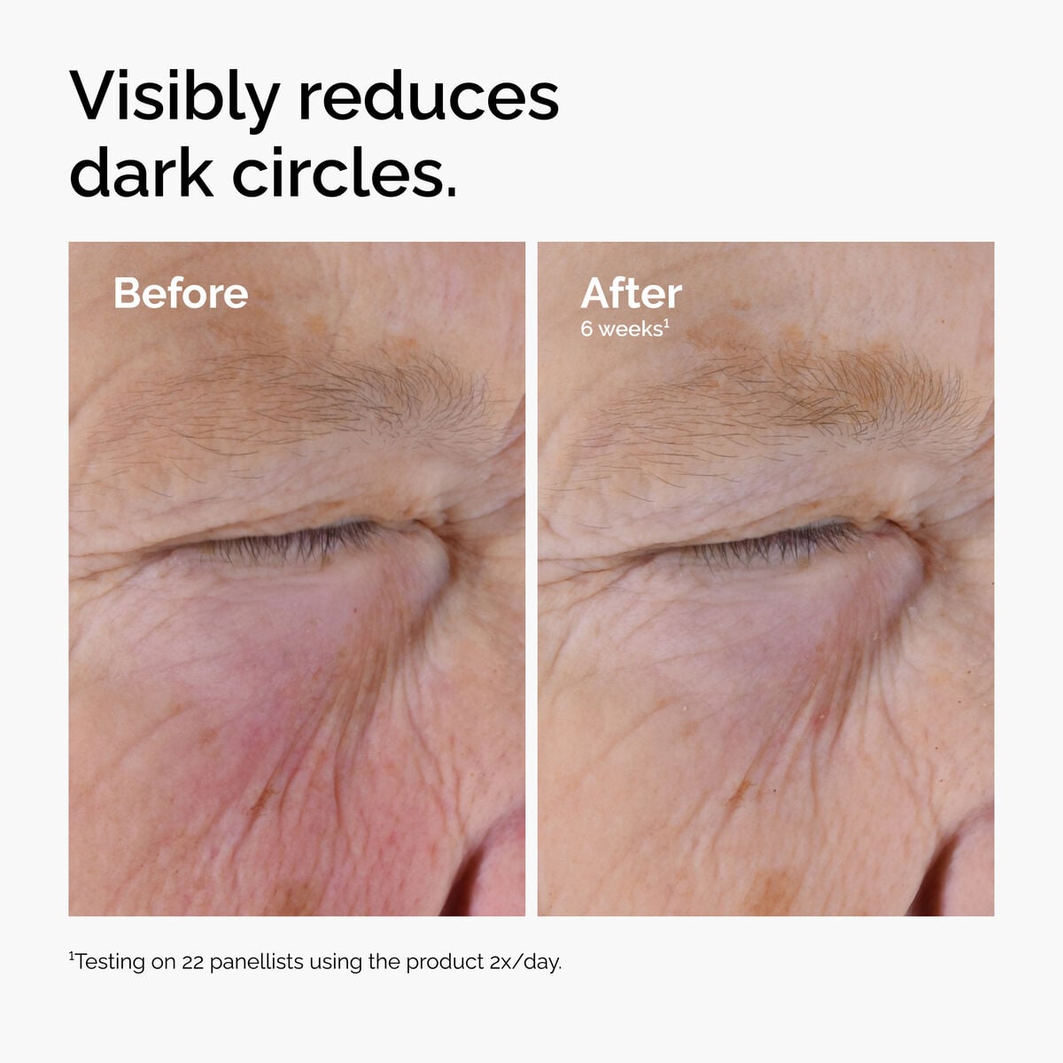caffeine-solution-5-egcg-eye-serum-r8 ord-caffeine-solution-egcg-dark-circles-before-after.jpg
