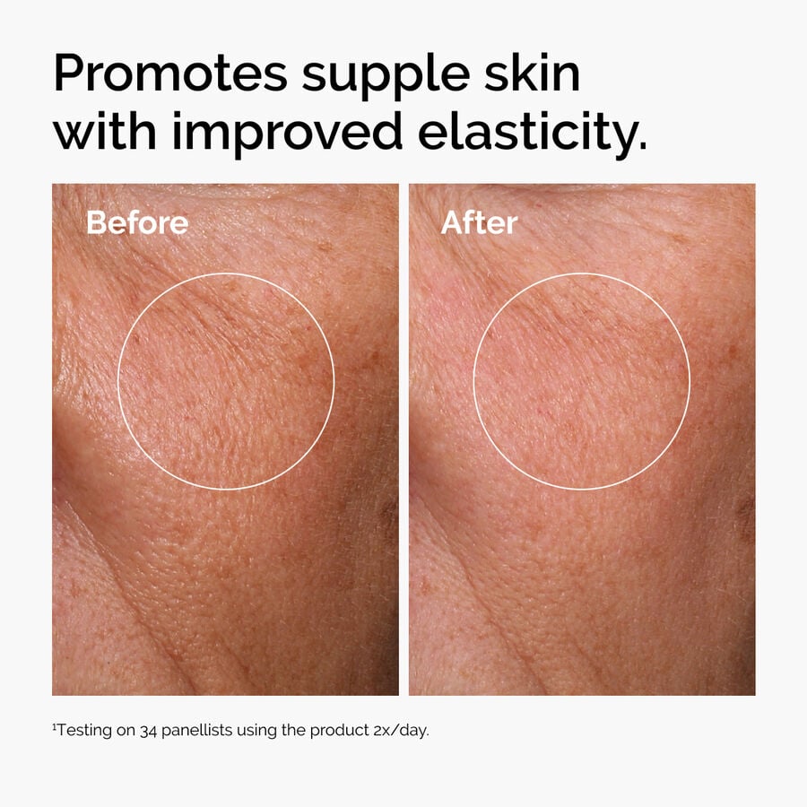 hyaluronic-acid-2-b5-with-ceramides-f9 ord-hyaluronic-acid-2pct-b5-hydrating-serum-before-after-elasticity.jpg
