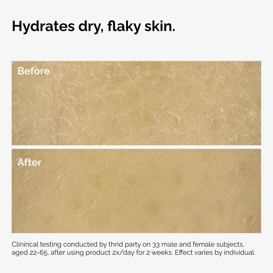 the-body-care-collection-t9 ord-natural-moisturizing-factors-inulin-body-before-after-graphic-02.jpg